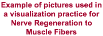 Example of pictures used in a visualization practice for Nerve Regeneration to Muscle Fibers